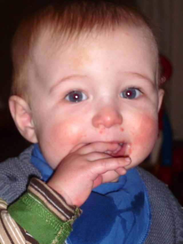 Our hand foot and mouth experience with a baby