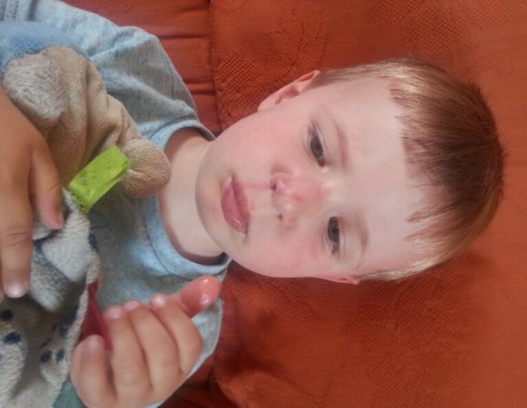 toddler swollen nose